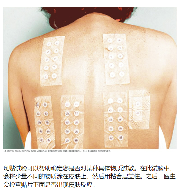 化妝品,分子量,道爾頓,皮膚,過敏原,數據 化妝品,分子量,道爾頓,皮膚,過敏原,數據