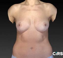 化妝品,功效評價,VECTRAH2 3D,醫美