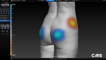 化妝品,功效評價,VECTRAH2 3D,醫美