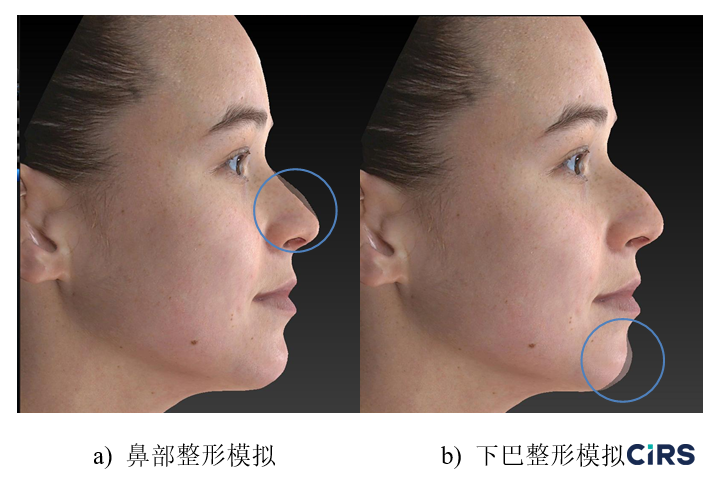 化妝品,功效評價,VECTRAH2 3D,醫美