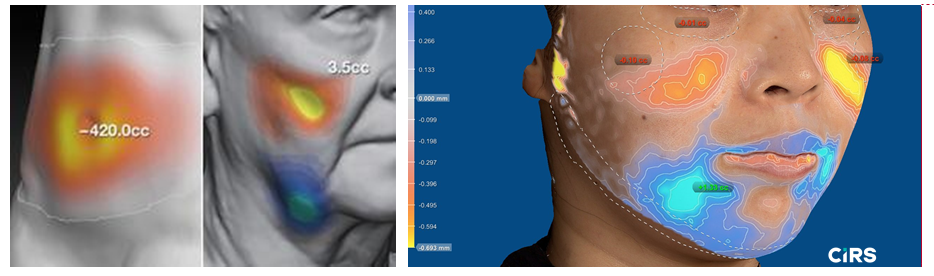 化妝品,功效評價,VECTRAH2 3D,醫美