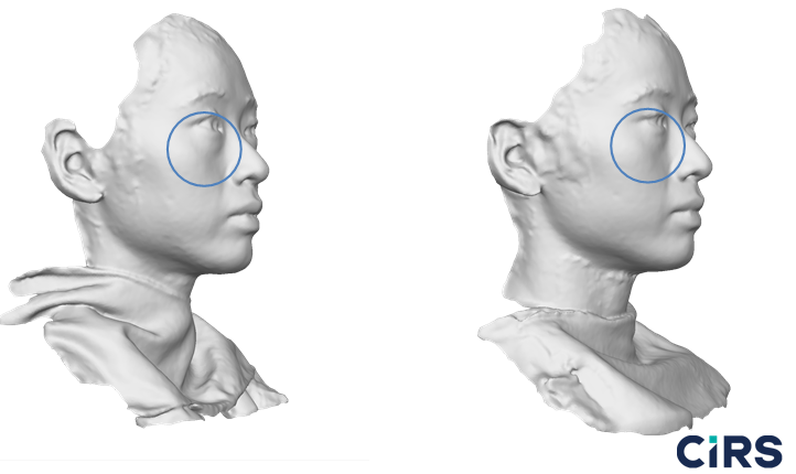 化妝品,功效評價,VECTRAH2 3D,醫美