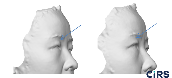 化妝品,功效評價,VECTRAH2 3D,醫美