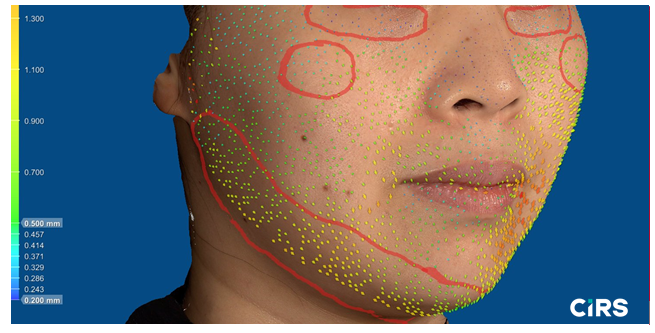 化妝品,功效評價,VECTRAH2 3D,醫美