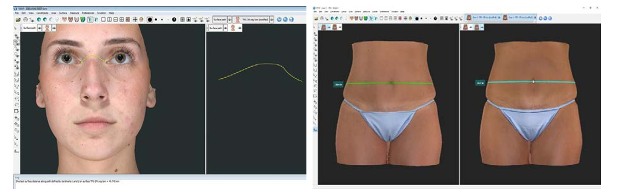 化妝品,功效評價,VECTRAH2 3D,醫美