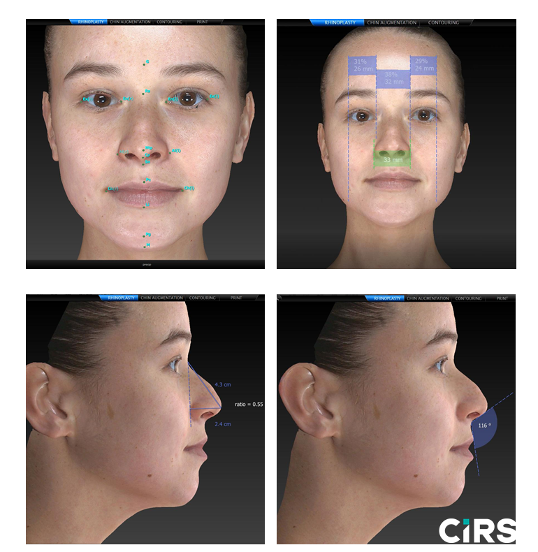 化妝品,功效評價,VECTRAH2 3D,醫美