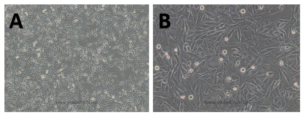 體外細胞,培養,模型,祛斑,美白,功效評估
